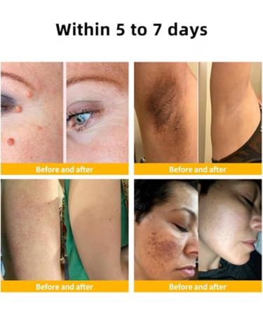 3Pcs Bee Venom Professional Gel | Professional New Bee Venom Repair Cream | Propolis Joint Cream for Neck | Waist | Back | Hands | Feet | and Legs | Hydrating Moisturizing Treatment Cream | 60G/2.12FL.OZ - Buy Online on GoSupps.com