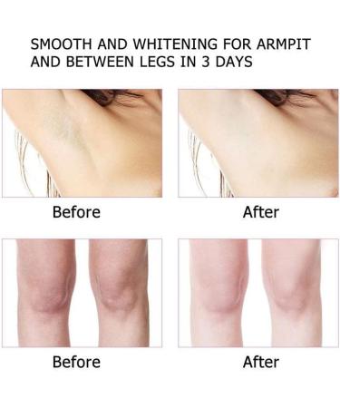  JPSDOWS Lightening cream for joints | Anti-odor cream for dark elbows 50 lightening cream for joints strong bleaching cream for women body - Buy Online on GoSupps.com