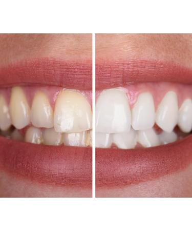 The Golden Smile |Kit de blanchiment dentaire professionnel avec poudre de charbon actif naturel - Buy Online on GoSupps.com