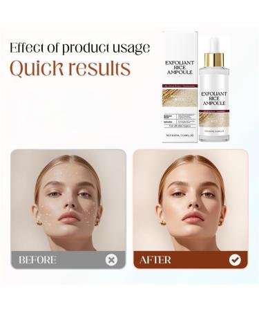 2 Pcs Black and White Rice Peeling Ampoule Deep Hydrates Skin Pore Cleansing Gentle Peel Shot Skin All Skin Types. Black Rice + White Rice 3.38 Fl Oz (Pack of 1) - Buy Online on GoSupps.com