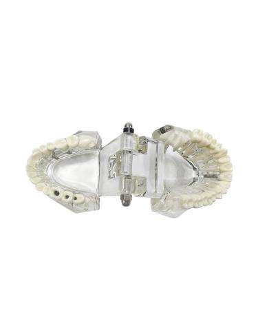 Buy Youya Transparent Dental Tooth Model for Dentists | Removable Pathological Teaching Model | International Shipping Available - Buy Online on GoSupps.com
