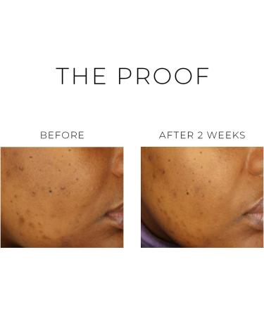 OSKIA Violet Water BHA Brightening Treatment Tonic 100ml VIOLET WATER BHA STATEMENT TREATMENT TONIC - Buy Online on GoSupps.com