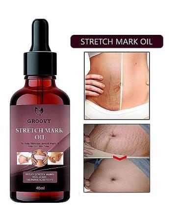 Stretch Mark Skin Oil - Reduce Scars Boost Elasticity | 40 ML - Best International Shipping - Buy Online on GoSupps.com
