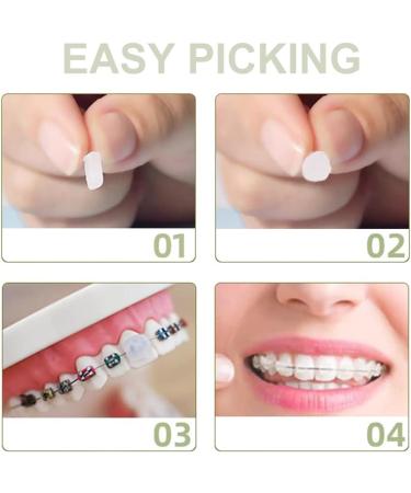 Cire Orthodontique pour Appareil Dentaire Cire orthodontique Ruban orthodontique Bretelles invisibles m cher correcteur bretelles protection - Buy Online on GoSupps.com