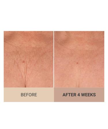 Consult Beaute Unscented Champagne Lift Hydrating Firming Body Cream with Pink Pepperslim Moisturizer Tightens Crepey Skin Tones & Hydrates Dry Skin on Arms & Legs - 8 oz. - Buy Online on GoSupps.com