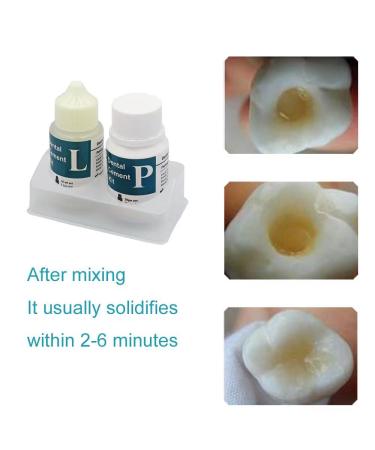 Broken Tooth Repair Kit - Temporary Teeth Replacement for Missing Fillings & Gaps | Improve Your Smile - Buy Online on GoSupps.com
