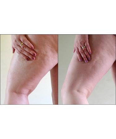 Aroma Derm Cello Gel Extra 33.9 Oz - Buy Online on GoSupps.com