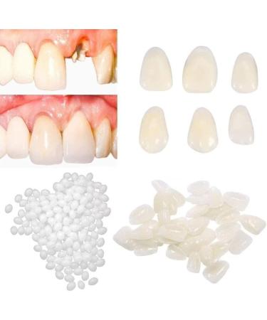 Womcare Temporary Tooth Repair kits for Filling The Missing Broken Tooth and Gaps-Moldable Fake Teeth and Thermal Beads Replacement Kits