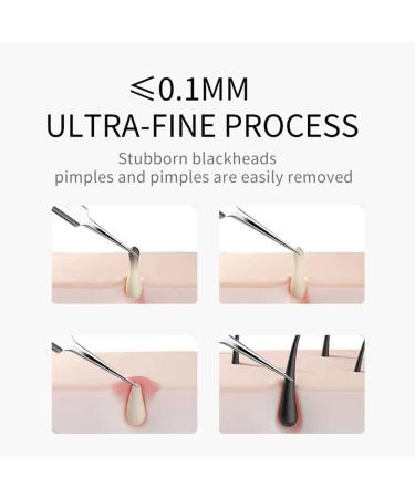 Ultra-fine No. 5 Cell Pimples Blackhead Clip Tweezers Acne Needle Blackhead Remover Kit Blackhead Remover Tweezers Black Dots Pore Cleaner Acne Needle Tool - Buy Online on GoSupps.com