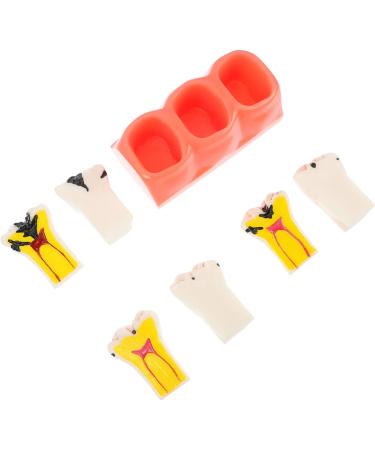 Ultechnovo Dental Recovery Tool Set - 2 Caries Tooth Models for Teaching & Demonstration | 12.5x7x6.5cm - Ideal for Dentistry Education - Buy Online on GoSupps.com