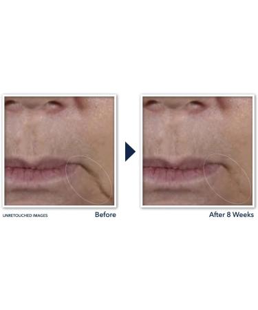 RoC - Multi Correxion Anti-Sagging Firm + Lift Face Cream - Prevent Facial Sagging & Enhance Contour Firmness - Hyaluronic Acid Bugrane & Shea Butter - Anti-Aging - Cosmetic Lifting Effect - 50 ml - Buy Online on GoSupps.com