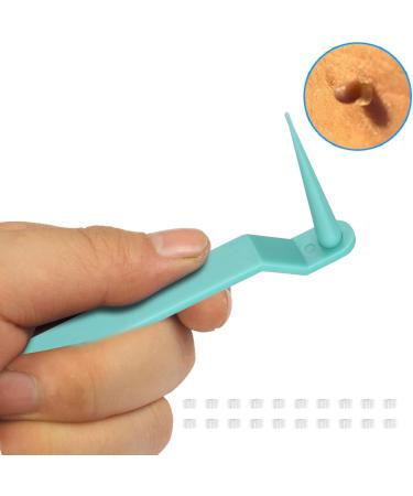 Fast Wart Removal Kit - 30PC Safe & Painless Micro Bands for Face Neck & Body - Buy Online on GoSupps.com