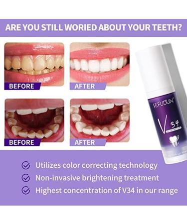  Hikaka Whitening Toothpaste V34 Color Correction Toothpaste Whitening Toothpaste Stain Removal 30 ml Improves Teeth Brightness and Reduces Yellowing (Blueberry) - Buy Online on GoSupps.com