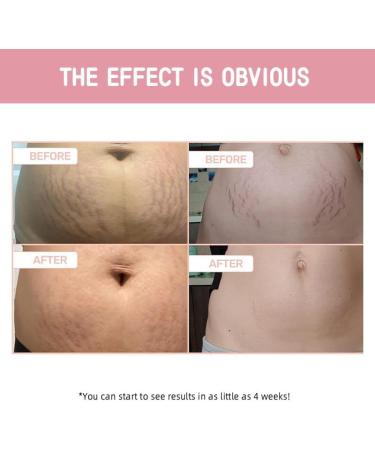  SONGVISON B-FLAT Tummy Firming Cream - Firming & Firming Skin Firming Body Cream Professional Collagen Body Lotion for Firmer & Conditioned Skin - Buy Online on GoSupps.com