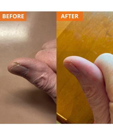 Yu-Be Moisturizing Skin Cream (1 fl. oz. Tube) - Japanese Relief Cream for Extra Dry Skin - Buy Online on GoSupps.com