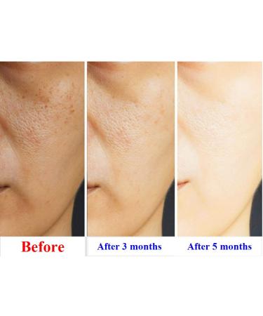 Whitesilk Derma Volufiline Bakuchiol Melatonin Cream - Instant Restore for Dullness & Loss of Firmness - Buy Online on GoSupps.com