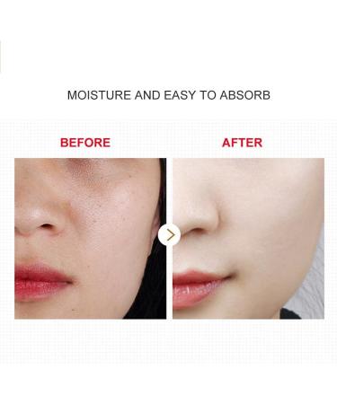 Advanced Vitamin C Serum Hyaluronic Essence Capsules Skin Care Cream Moisturizer For The Face Reduces Wrinkles Fine Lines Aging - Buy Online on GoSupps.com