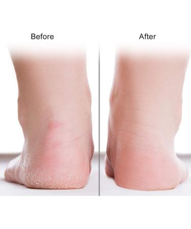 Silicone Sock Foot Protector - Moisture Care & Anti-Cracking - M Rosa | International Shipping - Buy Online on GoSupps.com