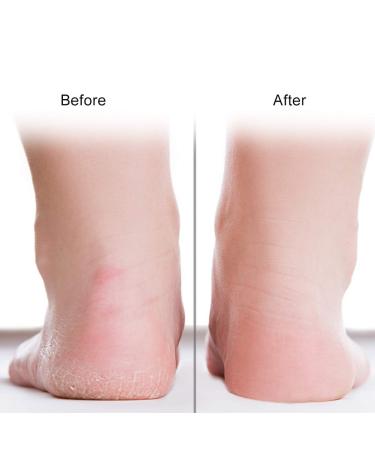 Silicone Moisturizing Gel Socks for Dry Feet & Cracked Heels Foot-Anti-Riss Protection (Pink L) | International Shipping - Buy Online on GoSupps.com