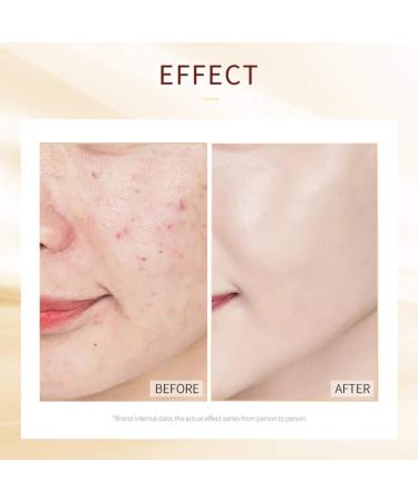 MIESCHER 20 Combo Pack Snail Sleeping Face Mask for Glowing, Moisturized Skin - Hydrating, Firming, and Brightening Natural Skincare - Buy Online on GoSupps.com