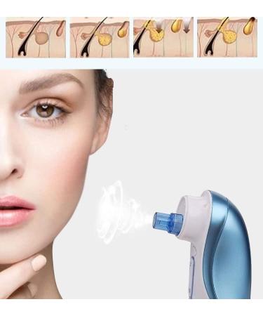 JYYBN Blackhead Remover Acne Blackhead Removal Tool 3 Suction Power Electric Pore Cleaner Blackhead Removal Tool with 5 Probes - Buy Online on GoSupps.com