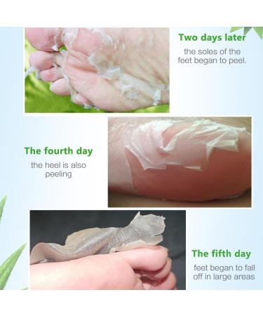 Foot Peel Mask 4 Pairs Natural Aloe Vera Gel Foot Mask-Foot Peel Mask For Hard Skin Footner Exfoliating Sock-Feet Hard Skin Remover-Plantifique Foot Peel Mask-Baby Feet Foot Peel (Aloe Vera) - Buy Online on GoSupps.com