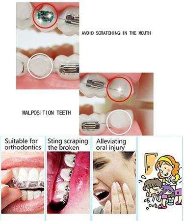 Angzhili 10 Pack Dental Orthodontics Wax for Brace Wearers Gum Protection (Multi-Color) - Buy Online on GoSupps.com