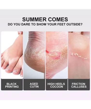 Foot Peel Mask 6 Pack - Lavender Infused Exfoliating Foot Care for Soft, Callus-Free Feet - Callus Repair and Dead Skin Removal Treatment for Men and Women - Buy Online on GoSupps.com