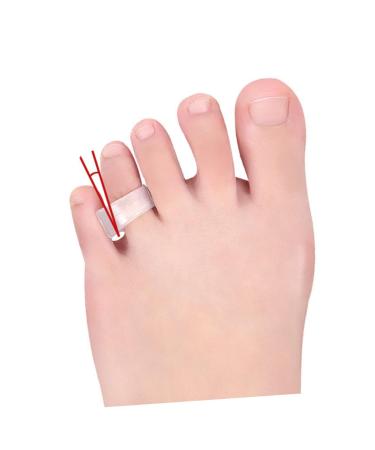 Lurrose Silicone Bunion Cushion Spacer - 4 Pairs Men's Gel Foot Care Tool for Women - Bunion Sleeve Separator - Buy Online on GoSupps.com