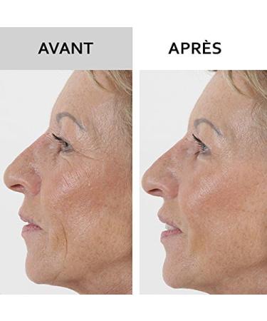 SKINEANCE - WRINKLE FILLER WRINKLE FILLER - Smoothes fills and smoothes fine lines and wrinkles - Precise instant and long-lasting results - Proven effectiveness - set of 3 tubes of 15 ml - Buy Online on GoSupps.com