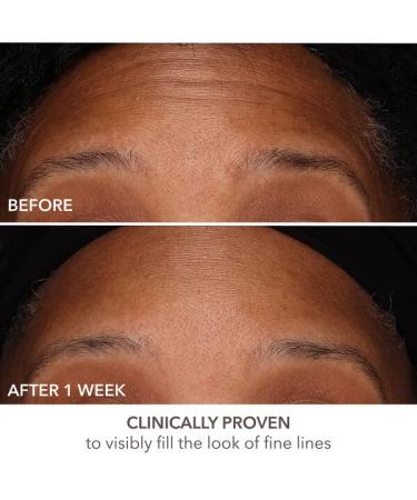 Dr Dennis Gross DermInfusions Fill + Repair Serum - Instant Line Filler & Skin Plumper 1 oz | International Shipping Available - Buy Online on GoSupps.com