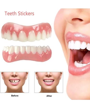 Buy Iksvmsi 4-Piece False Teeth Veneers - Temporary Dentures for Men & Women - Perfect for Bad Teeth - International Shipping Available - Buy Online on GoSupps.com