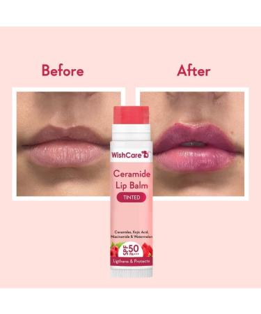 Buy wish_care Tinted Ceramide Lip Balm with Niacinamide - Lip Lightening & Protection (5g) | Best International Shipping - Buy Online on GoSupps.com