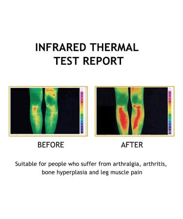 Tourmaline Self-Heating Knee Braces - Magnetic Arthritis Support Belt for Pain Relief | Ship Worldwide - Buy Online on GoSupps.com