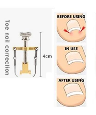 Ingrown Toenail Corrector & Thick Nail Clipper Set - Stainless Steel Heavy-Duty Tools for Podiatrist Treatment - Long Handle Pedicure Kit (10pcs) - Buy Online on GoSupps.com