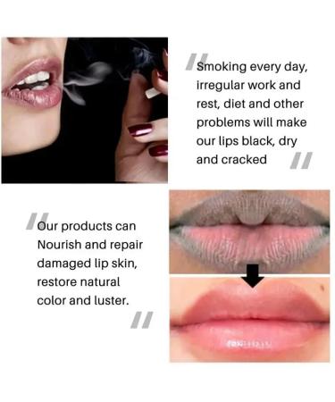 2PCS Lip Lightening for Dark Lips Lip Brightener for Smokers Dark Lip Treatment Lightening Cream for Pink Lips Lip Lightener for Smoker Lips Lip Lightening balm for Men and Women - Buy Online on GoSupps.com