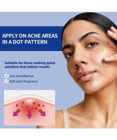 Acne Cream 20g | Acne Gel for Face | Cleansing Cream for Women & Men (1pc) - Buy Online on GoSupps.com