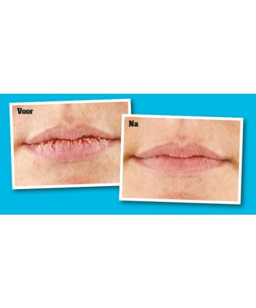 O'Keeffe's Lip Repair - Cooling | Intense Hydration & Soothing Relief for Soft Lips - International Shipping Available - Buy Online on GoSupps.com