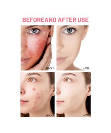 DISAAR Beauty Rose Ceramide Facial Wash Soothing Repair Cleansing Moisturizing Acne Removal Face Oil Control 100g/3.38fl.oz - Buy Online on GoSupps.com