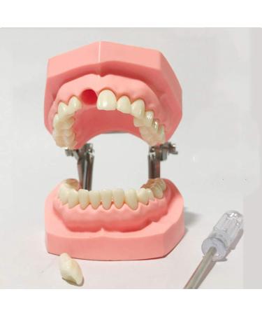 Ernzi dentures model - removable typodont teeth model - removable teeth - dental preparation practice - for study lessons