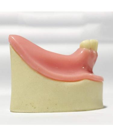 DYTAH Dental Implant Teeth Model - Lower Jaw 6 Teeth for Dental Students | Soft Gum Teeth Teaching Aid - Buy Online on GoSupps.com