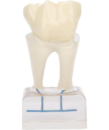 Professional Dental Nerve Model for Teaching | Resin Tooth Model for Students | International Shipping - Buy Online on GoSupps.com