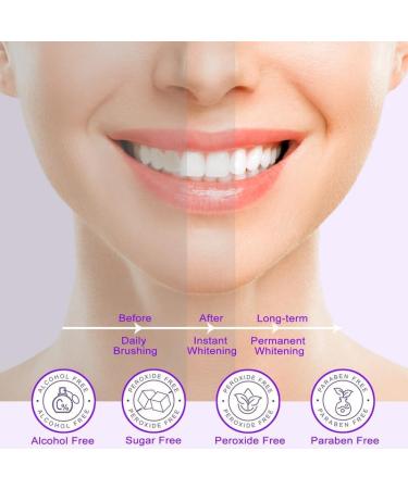 Purple Toothpaste for Teeth Whitening - Instant Whitening Colour Corrector Serum - Purple Toothpaste Whitening for Neutralizes Tooth Stains - Color Corrector - Buy Online on GoSupps.com