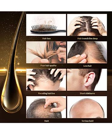 MKKENLEY Magic Hair Growth Tonic with Ginseng for Fast Hair Growth | Best Treatment for Men and Women with Baldness | Nourishing Scalp and Anti-Hair Loss Formula for Hair Regrowth - Buy Online on GoSupps.com