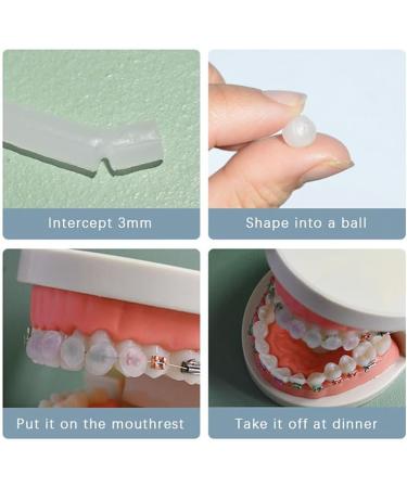 Premium Dental Wax for Braces & Aligners - 5 Food-Grade Strawberry Strips in Storage Box - Buy Online on GoSupps.com