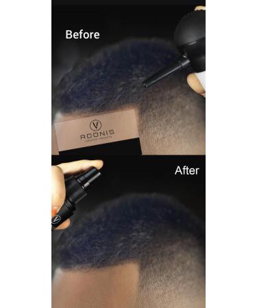 Buy COMPLETE SET 5-in-1 ADONIS Hair Fiber Kit - All Natural Keratin Hair Fibers for Thinning Hair | Fast International Shipping - Buy Online on GoSupps.com