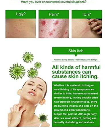 Herbal Cream for Itching Relief - Allergy, Itchy Skin, Dry Skin Treatment - Buy Online on GoSupps.com