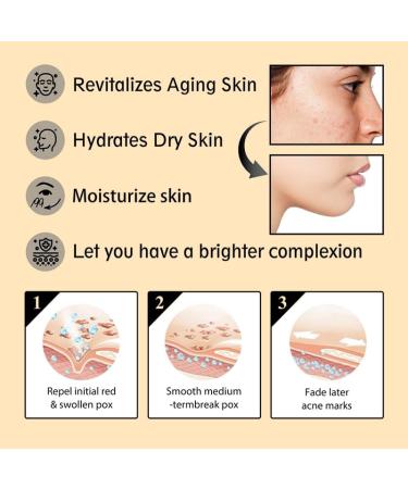 Snail Mucin Moisturizing Cream - 92% Snail Collagen Anti-Wrinkle Serum for Hydration & Firming | Daily Facial Repair Gel for Dry & Sensitive Skin - 3.52 fl oz - Buy Online on GoSupps.com