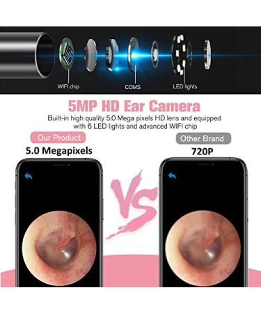 Wireless Otoscope with Camera for Ear Wax Removal - 1080P WiFi Ear Cleaner for iOS Android - Visual Ear Endoscope for Adults, Kids & Pets - Pink - Buy Online on GoSupps.com