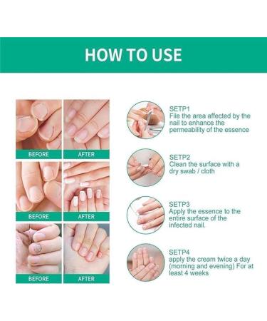 2024 New 5pcs Nail Fungus Treat-ment for Toenail Kerassentials Toenail Fungus Treat-ment Oil Kerassentials for Toenail Fungus Kerasentials Nail Treat-ment 30ml/1fl.oz - Buy Online on GoSupps.com